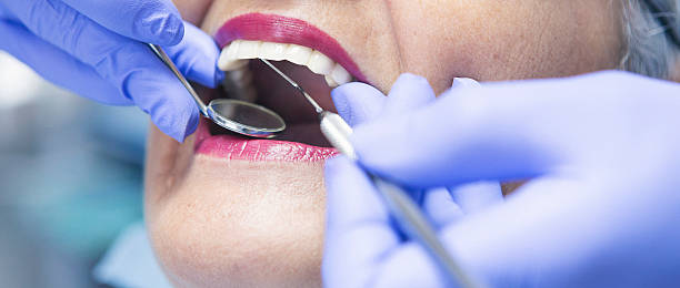 Best Emergency Dental Surgery in Highpoint, OH